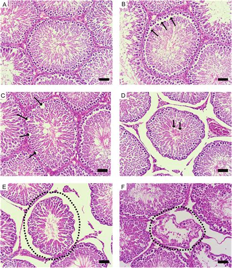 Seminiferous Tubule Morphology A Normal Morphology In Download