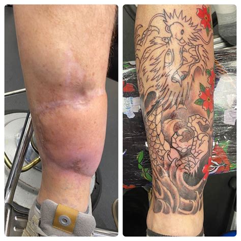 33 Can You Tattoo Over Spider Veins SikanderSarea