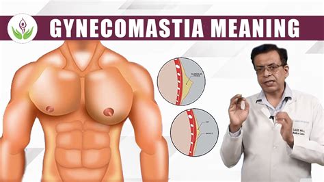 What Is Gynecomastia Meaning Best Gynecomastia Treatment In Delhi Care Well Medical Centre