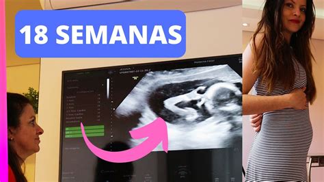 Finalmente Senti O Bebe Mexer Consulta Pre Natal Diario Da Gravidez 18 Semanas Cha