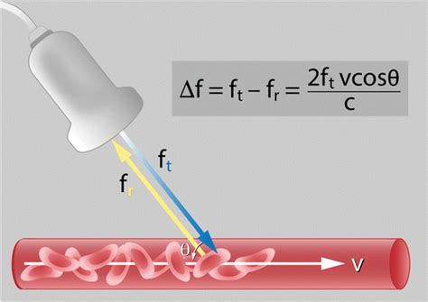 Optimizing Image Quality When Evaluating Blood Flow At Doppler Us A