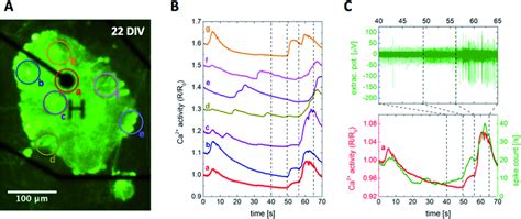 Simultaneous Recording Of Intra And Extracellular Neuronal Activity Download Scientific