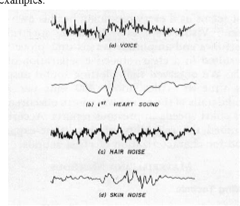 Figure 1 From Visual Lung Sound Characterization By Time Expanded Wave