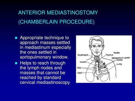 PPT SURGICAL APPROACH TO MEDIASTINAL LESIONS PowerPoint Presentation