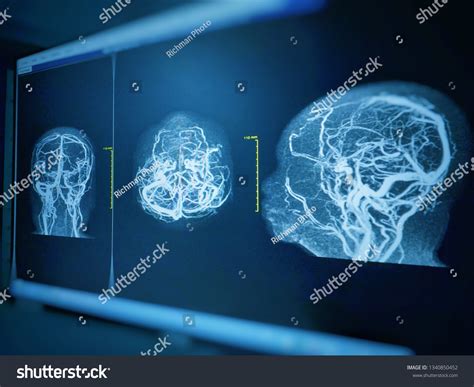 Mra Scan Images Stock Photos Vectors Shutterstock