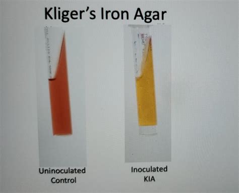 Solved Refer To The Photographs Of The Kligler S Iron Agar Chegg