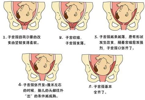 孕媽生產時將經歷的四段產程和注意事項 每日頭條