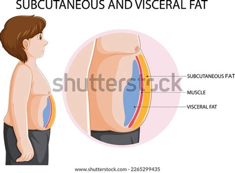 Subcutaneous Visceral Fat Diagram Illustration Stock Vector Royalty