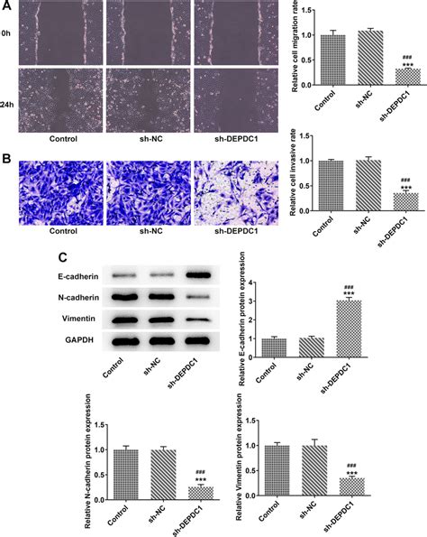 Down Regulation Of Depdc Inhibited Metastasis Of Os Cells A The