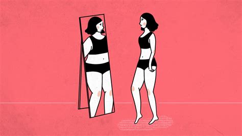 Causes Of Body Dysmorphia To Never Ignore Power Of Positivity