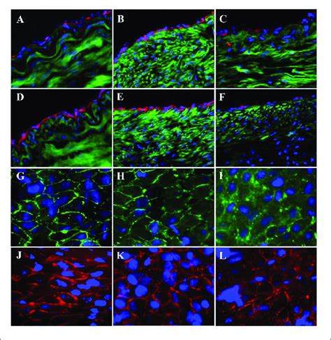 | Expression of endothelial biomarkers in neo-endothelial cells of ...