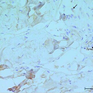 Representative Immunohistochemical Photomicrograph Of The Global