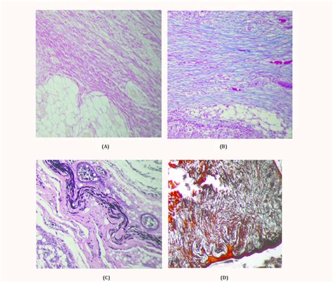 A Van Gieson For Collagen Fibers Red Color 10 B Masson Trichrome