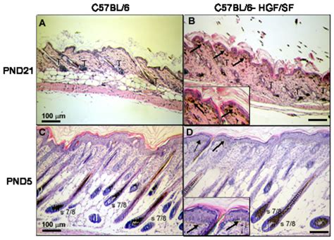 Haematoxylin And Eosin Staining Of Mouse Skin Of Different Age And Hair