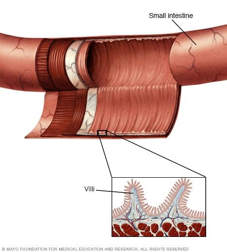 Small Intestine Lining Mayo Clinic