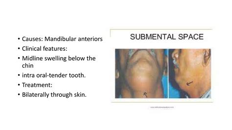 Fascial Spaces In The Head And Neck Ppt