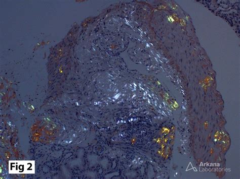 Congo Red Stain | Teaching Points | Arkana Laboratories