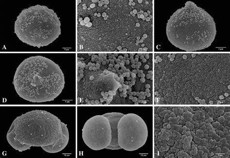 Sem Micrographs Of Airborne Pollen Grains Of Gymnosperm A­c Juniperus Download Scientific