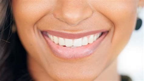 How Cosmetic Dentistry Can Improve Your Confidence City View Dental