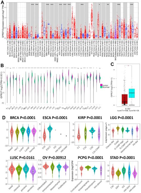 The Transcription Levels Of Gpr In Human Cancers Gpr Mrna