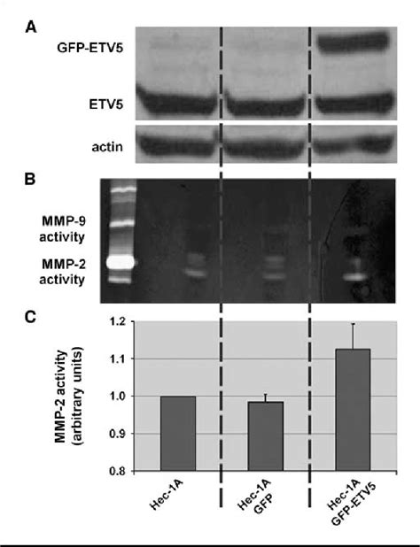 Figure From Erm Etv Up Regulation Plays A Role During Myometrial