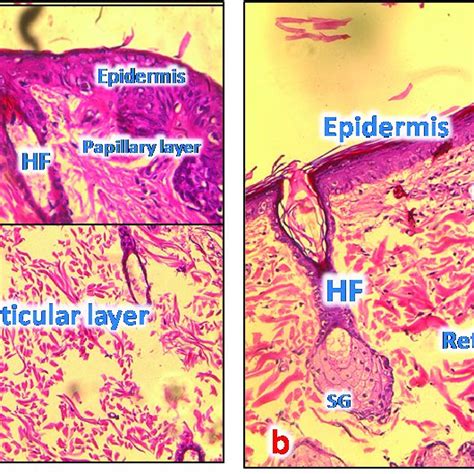 A A Photomicrograph Of The Section Of T1 Treated Group For 72 Hours