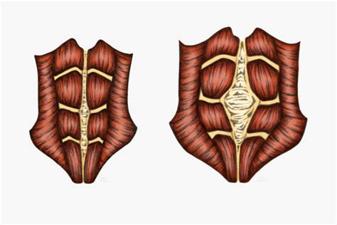 Diastasis Recti Exercises for Men: 7 Best Exercises to Heal It – DMoose