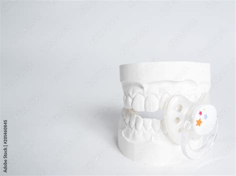 Minimizing The Malocclusion Caused By Pacifiers The Gypsum Tooth With
