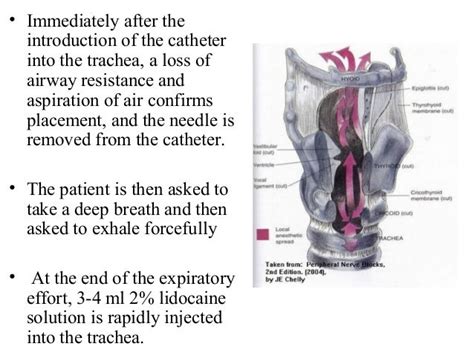 Fiberoptic intubation