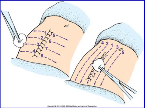 Wound Care Flashcards Quizlet