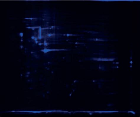 The Result Of 2D DIGE Shows 17 Proteins Differentially Expressed