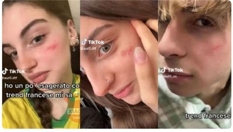 El peligroso reto viral autolesivo de TikTok que prendió las alarmas en