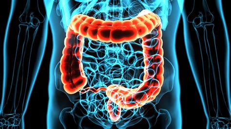 Polypes Intestinaux Comment Les Traiter