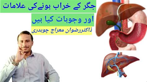 Signs Symtoms Cuasess Of Liver Disease Jigar Ki Khrabi Ki Alaamt Or