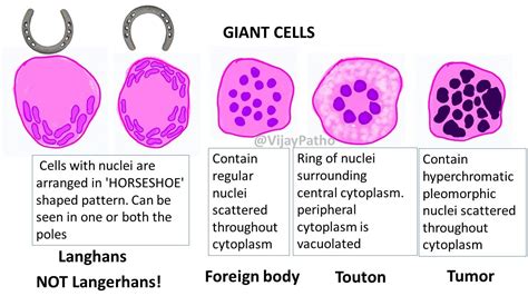 Giant Cells in Pathology for Medical Students