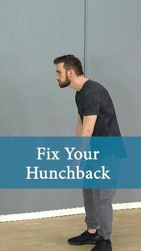 How To Fix Forward Head Posture 5 Exercises And Stretches Artofit