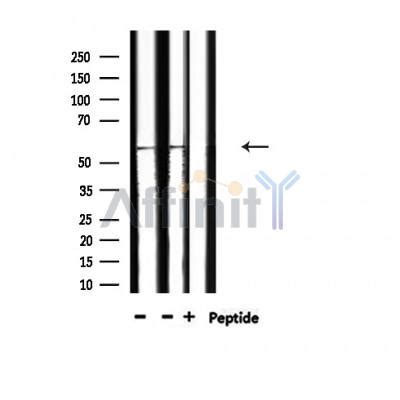 Phospho Src Tyr Tyr Antibody Affinity Biosciences Ltd