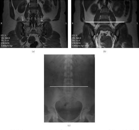 Figure 2 From Evaluating The Reliability Of Anatomic Landmarks In Safe