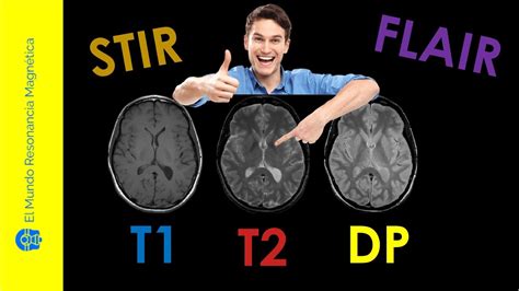 Vídeo 11secuencias De Resonancia Magnética Parámetros T1 T2 Dp T2