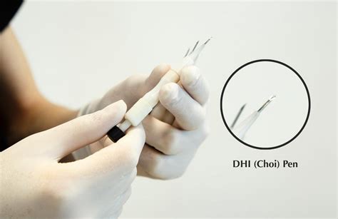 Hair Transplant With Dhi Dr Merdan Çelik