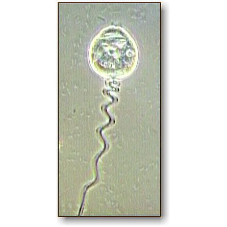 Vorticella | Microbus Microscope Educational Website