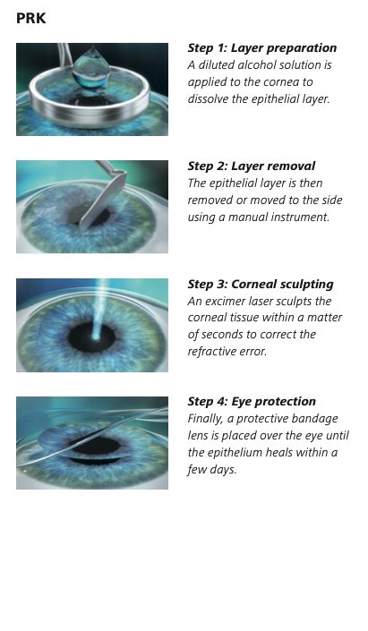 PRK vs LASIK - Clearvision Eye Clinic & LASIK Centre Singapore