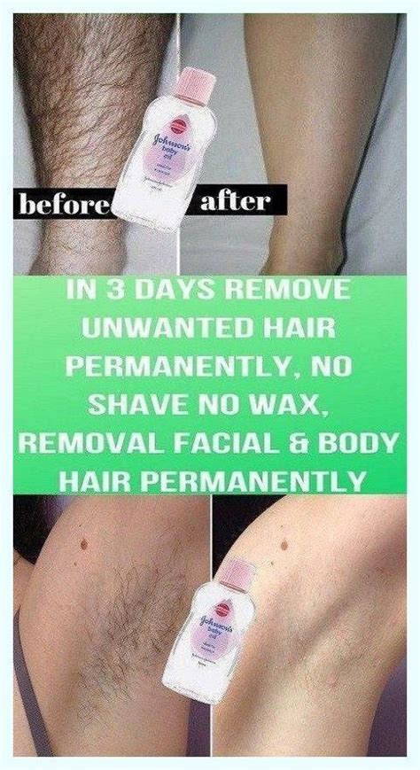 Remove Unwanted Hair Permanently In Three Days No Shave No Wax Removal Facial And Body Hair