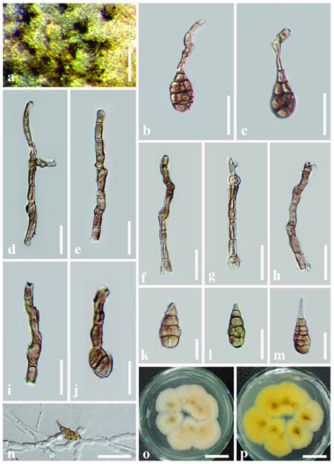 Alternaria Pseudoinfectoria Mflu Holotype A Colonies On