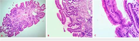 Histologic Sections Hematoxylin And Eosin Stained A 10x B 20x C