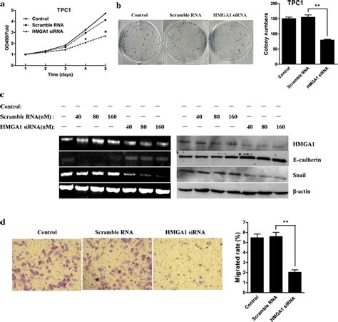 Sirna Mediated Hmga1 Knockdown Inhibited Thyroid Cancer Cell