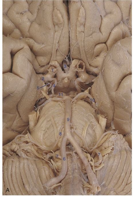 Inferior View Of Brain Diagram Quizlet