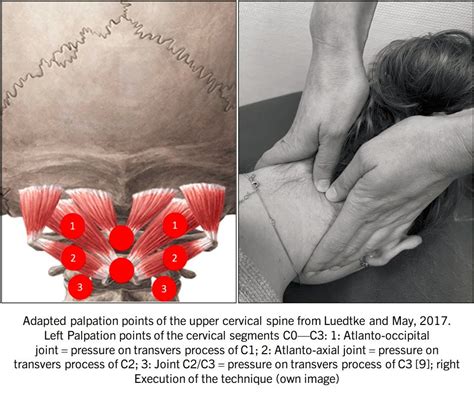 Physio Meets Science On Twitter Only Cervical Vertebrae C C Not C