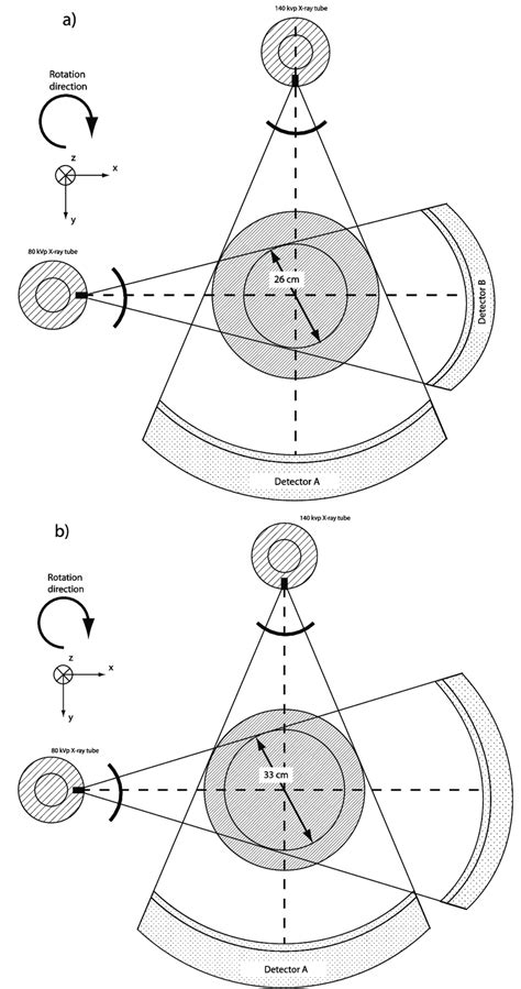 Schematic Drawings Of The Siemens Dual Energy Ct Scanners A Somatom Download Scientific