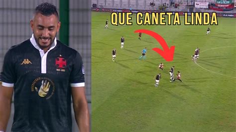 O Show De Habilidades De Payet Nessa Partida Payet Vs Maldonado 21